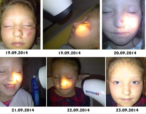 Lampa BIOPTRON Pro 1 Zepter GRATIS z Filtrem Fulerenowym + statyw stołowy + 7 Filtrów Koloroterapii Lampa BIOPTRON Pro 1 Zepter GRATIS z Filtrem Fulerenowym + statyw stołowy + 7 Filtrów Koloroterapii